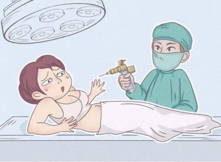 全身抽脂對身體有什么傷害？